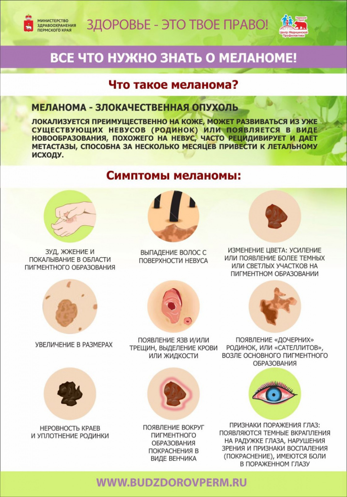 Меланома2.jpg